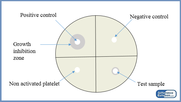 positive and negative control in an experiment